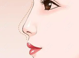 m.23美@佳6z.co/m3d打印整形王輝在哪個醫(yī)院?在杭州一佳醫(yī)療美容門診部坐診,可預約