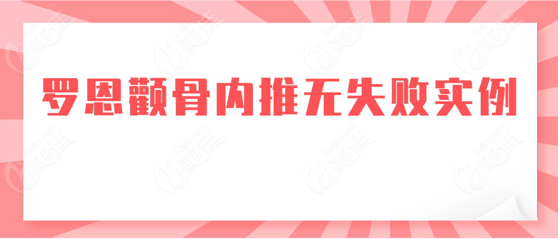 罗恩颧骨内推无失败实例