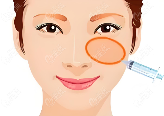 肤美达胶原蛋白适合打哪里？