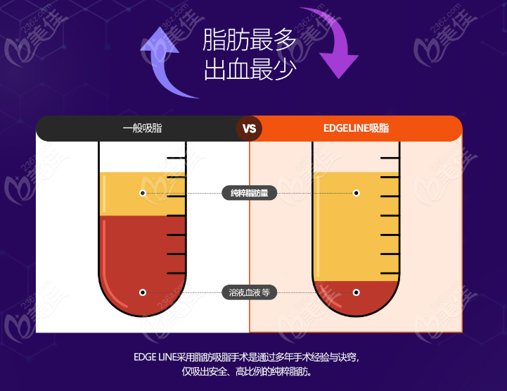 韩国的Egline整形医院的吸脂技术