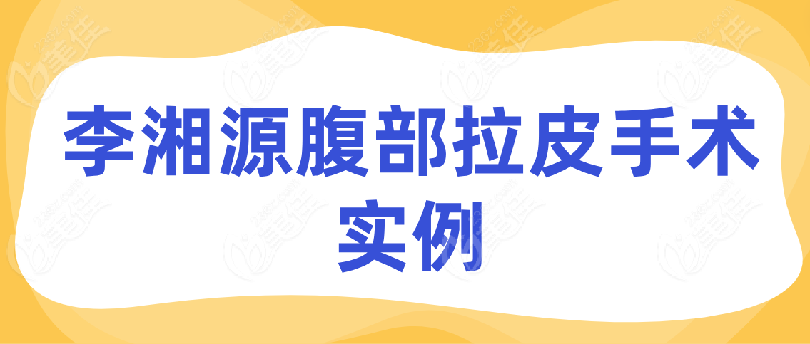 李湘源腹部拉皮手术实例