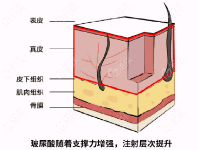 236z.com姣月女神玻尿酸