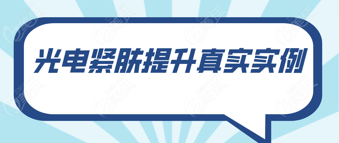 光电紧肤提升真实实例分享