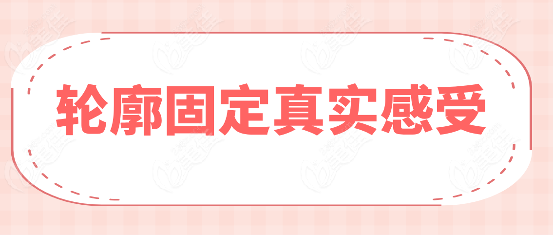 轮廓固定真实感受
