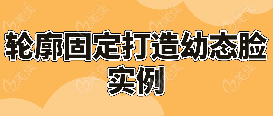 轮廓固定打造幼态脸实例分享