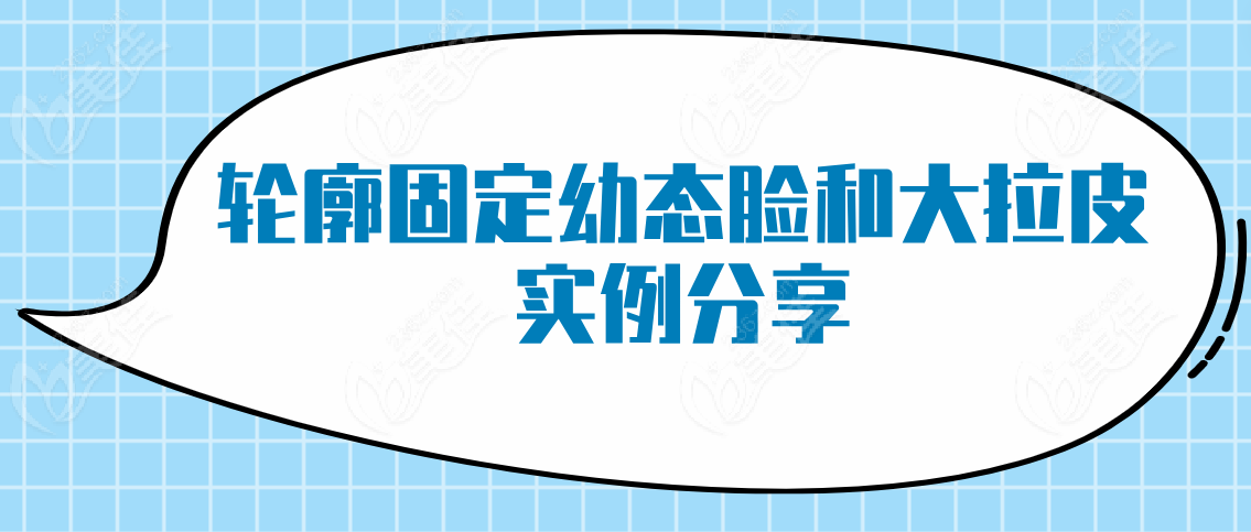 轮廓固定幼态脸和大拉皮实例分享