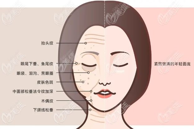 面部提升哪个医生做得好