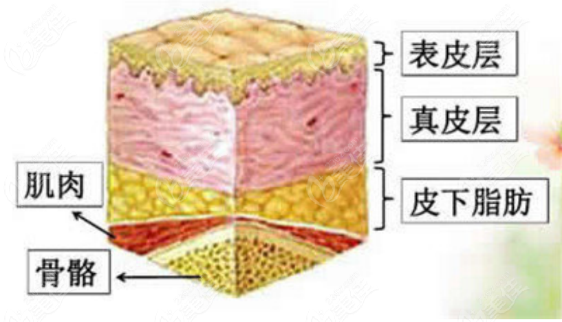 蔓芙佳玻尿酸