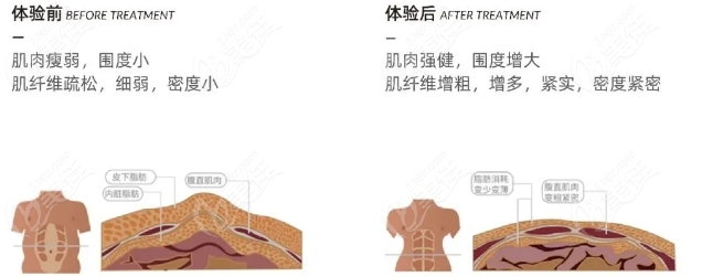 酷拉美形冷冻减脂做一次有成效