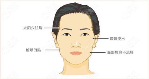 骨韧双休术是综合类美容项目