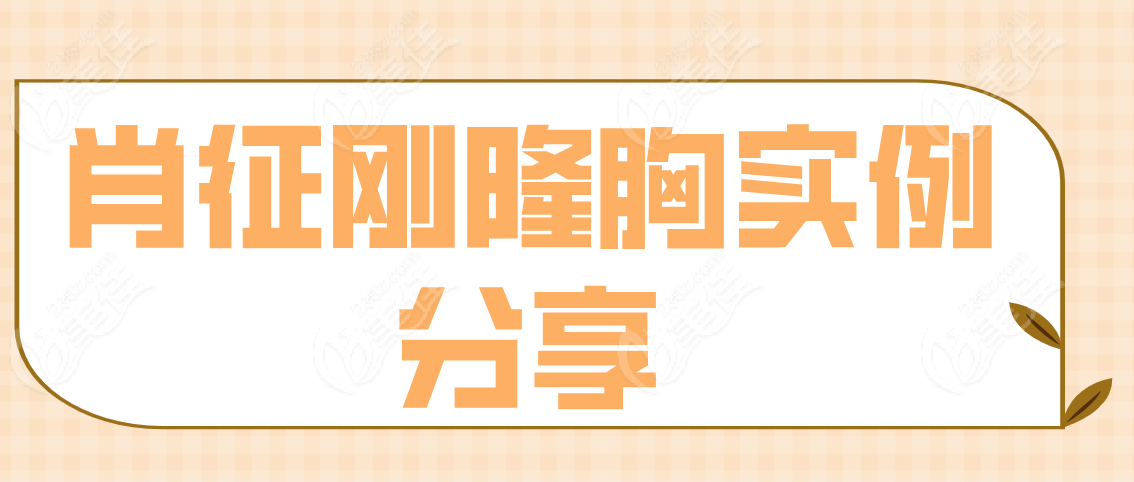 肖征刚隆胸实例分享