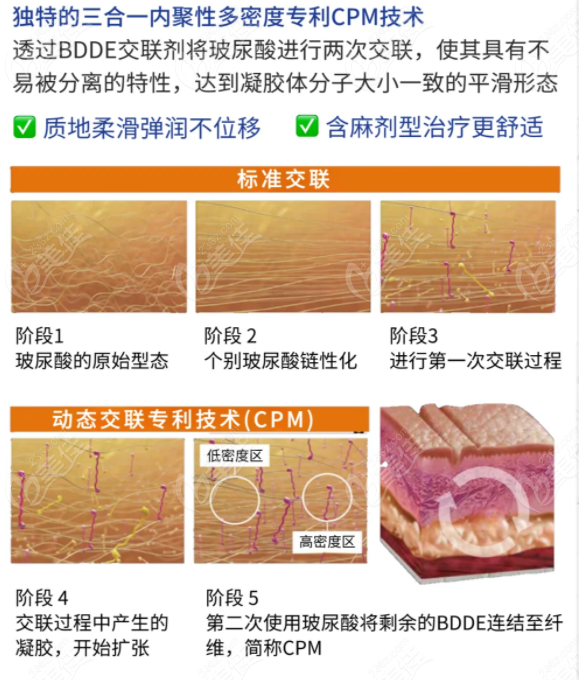 说保柔缇玻尿酸的特点优势