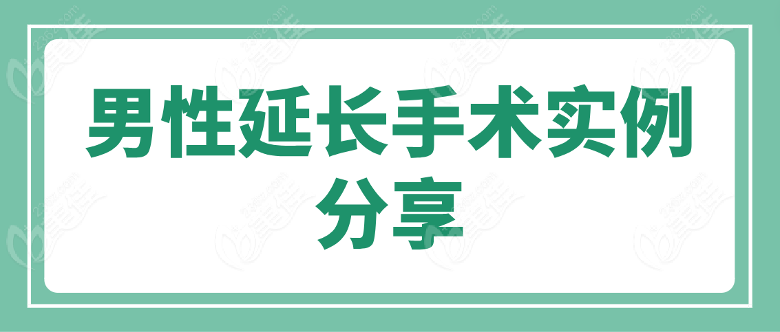 男性延长手术实例分享