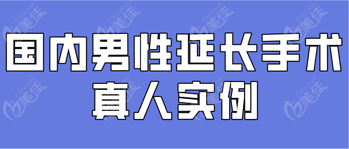 国内男性延长手术真人实例分享