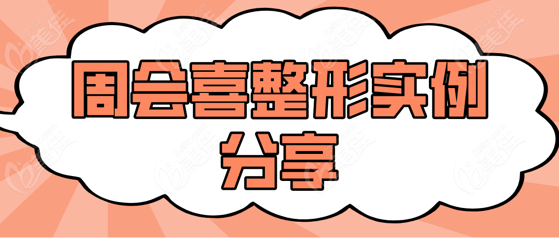 周會(huì)喜整形實(shí)例分享