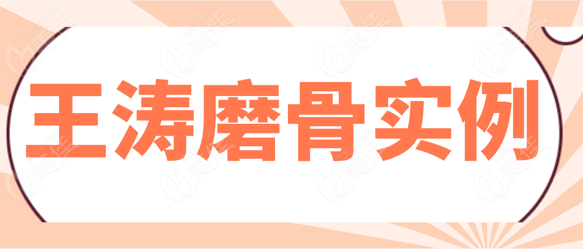 王濤磨骨實(shí)例分享