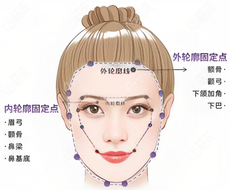 babyface凹陷填充用玻尿酸+再生材料的优势