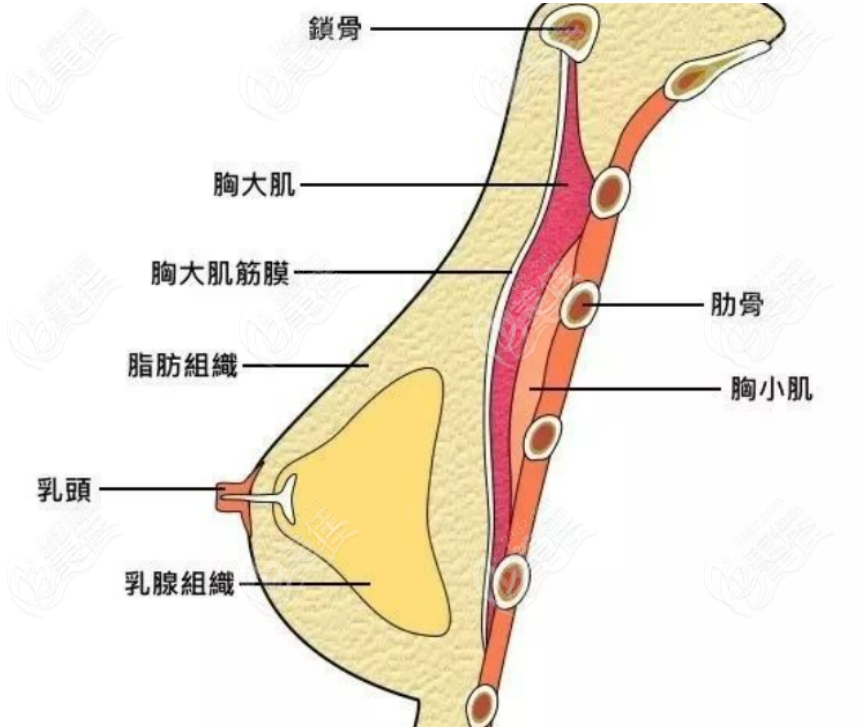  NC隆胸手术