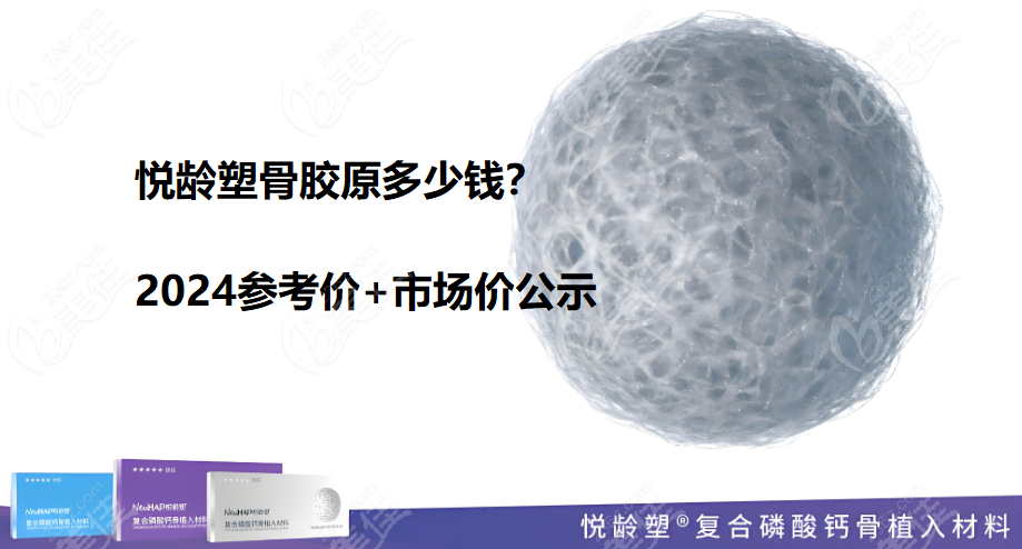 悦龄塑骨胶原多少钱?2024参考价+市场价公示