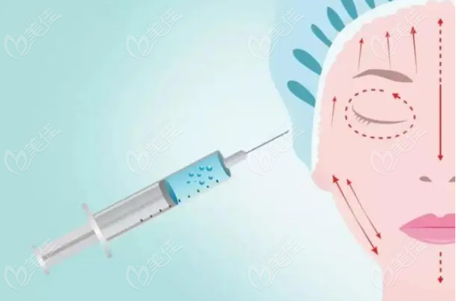 杭州薇琳医疗美容医院童颜针多少钱？