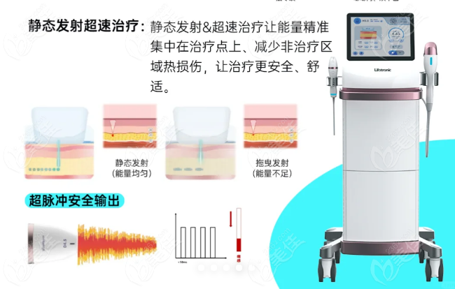 钻石超声炮适应人群