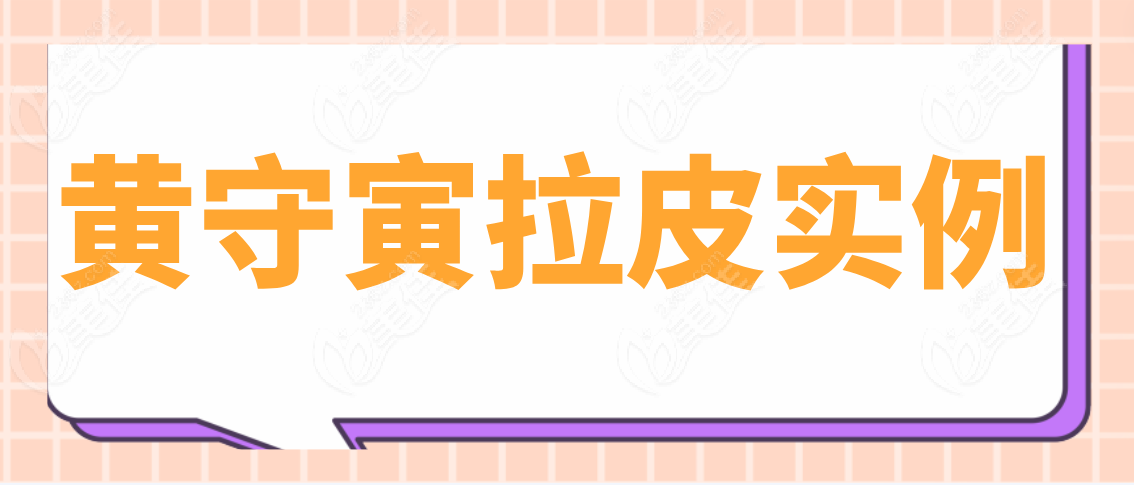 黄守寅拉皮实例分享