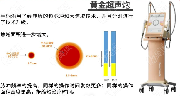 黄金超声炮适合什么人群使用