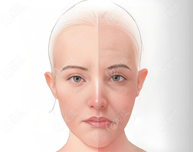 针美汇小针轻医美会越打越容易老吗www.236z.com 针美汇小针轻医美会越打越容易老吗www.236z.com