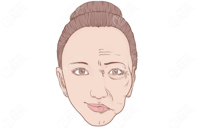 针美汇的优点 针美汇的优点