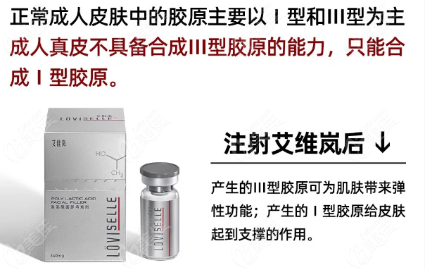 艾维岚童颜针注射打全脸一次需要3-8瓶左右
