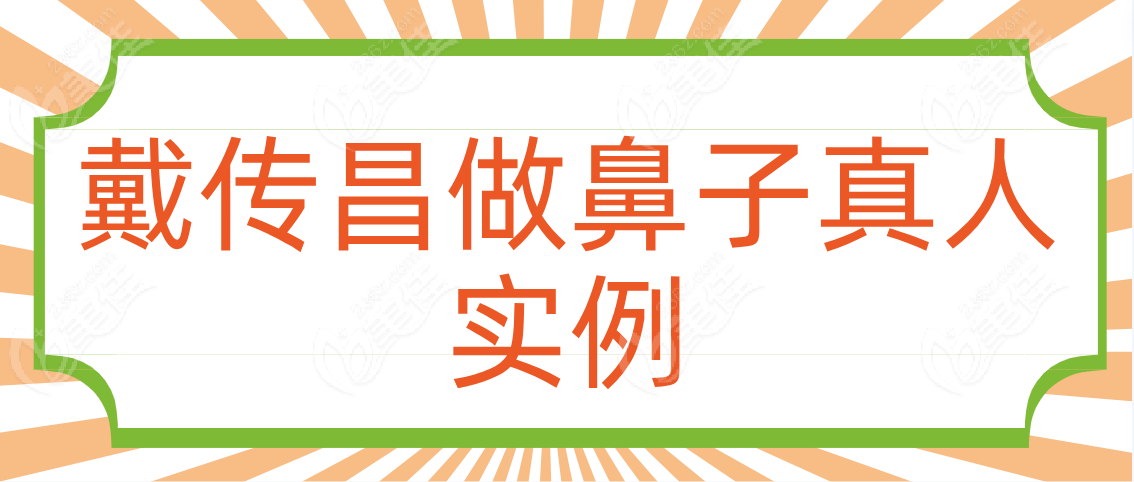 戴傳昌做鼻子真人實例