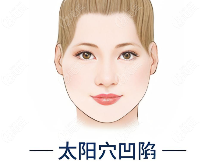 太阳穴凹陷www.236z.com