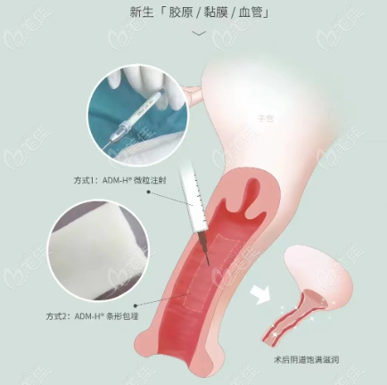 上海紧缩针预约流程 上海紧缩针预约流程