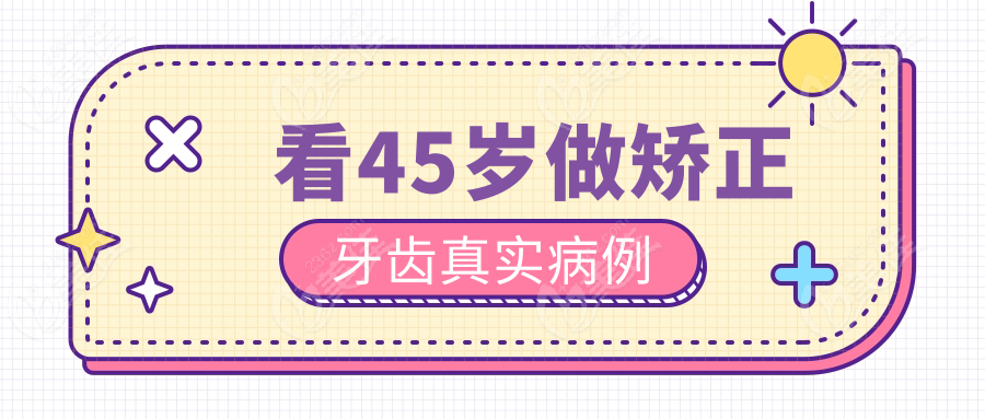 看45岁做矫正牙齿真实病例