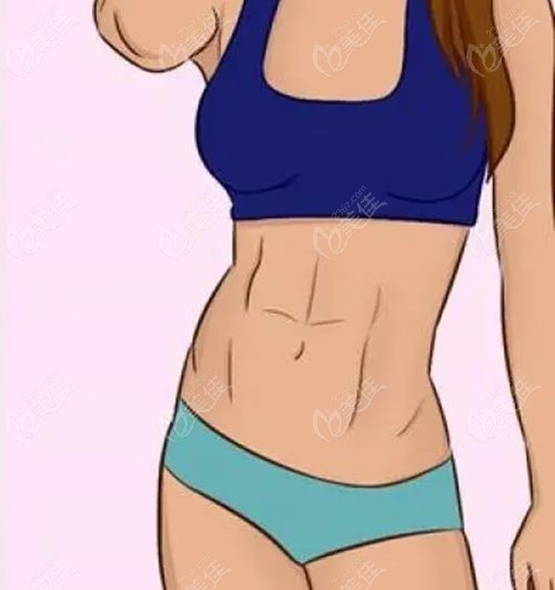 武漢王彬吸脂的口碑如何