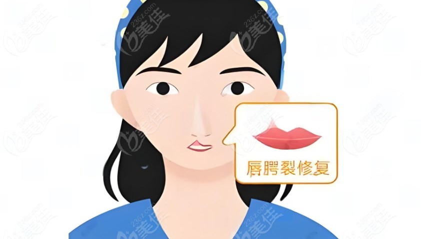 李精韬唇裂修复做得好