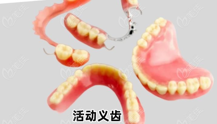 无锡镶牙好的医院介绍
