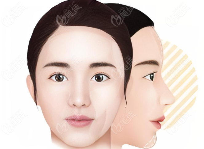 王自謙脂肪修復(fù)怎么樣？王自謙面部脂肪饅化修復(fù)實(shí)例給你答案