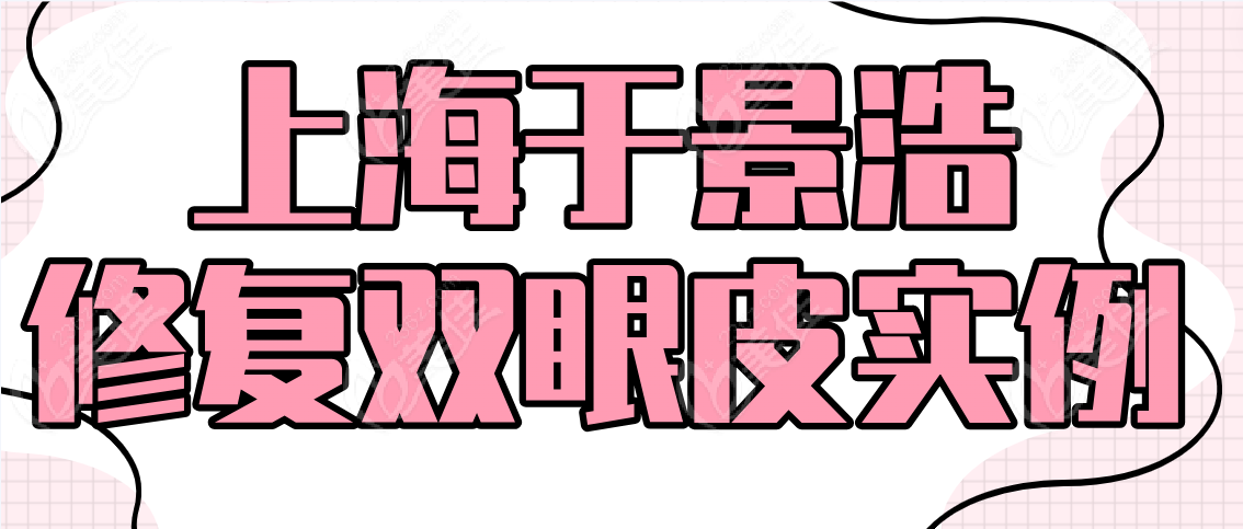 上海于景浩修复双眼皮实例