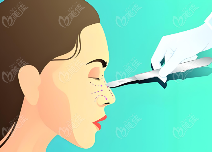 许炎龙眼鼻整形手术技术怎么样？