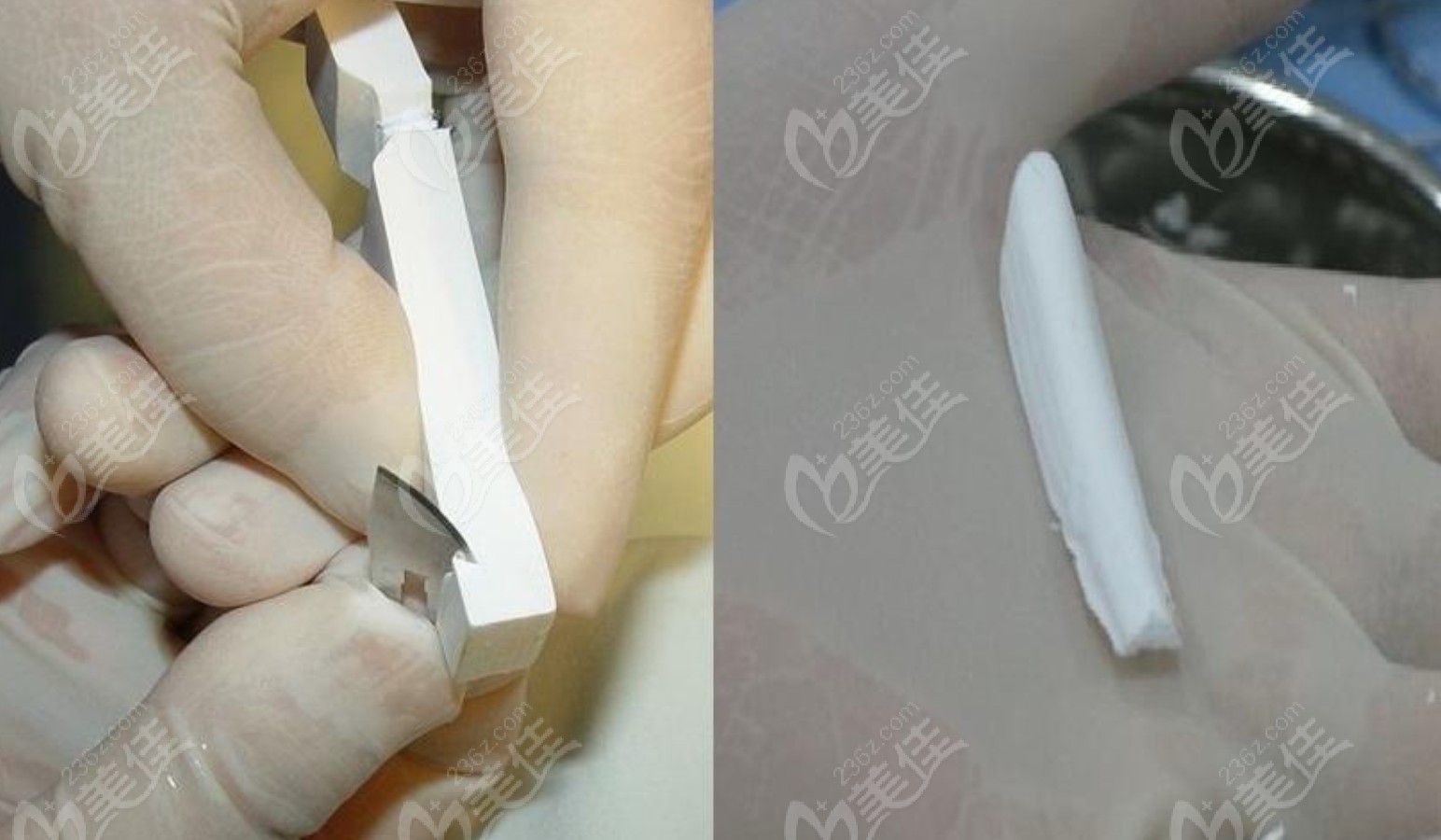 美植挺膨体是合格的