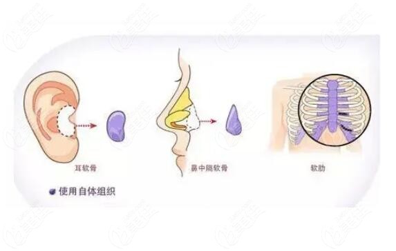 沈陽(yáng)做攣縮鼻修復(fù)好的醫(yī)院排名詳細(xì)