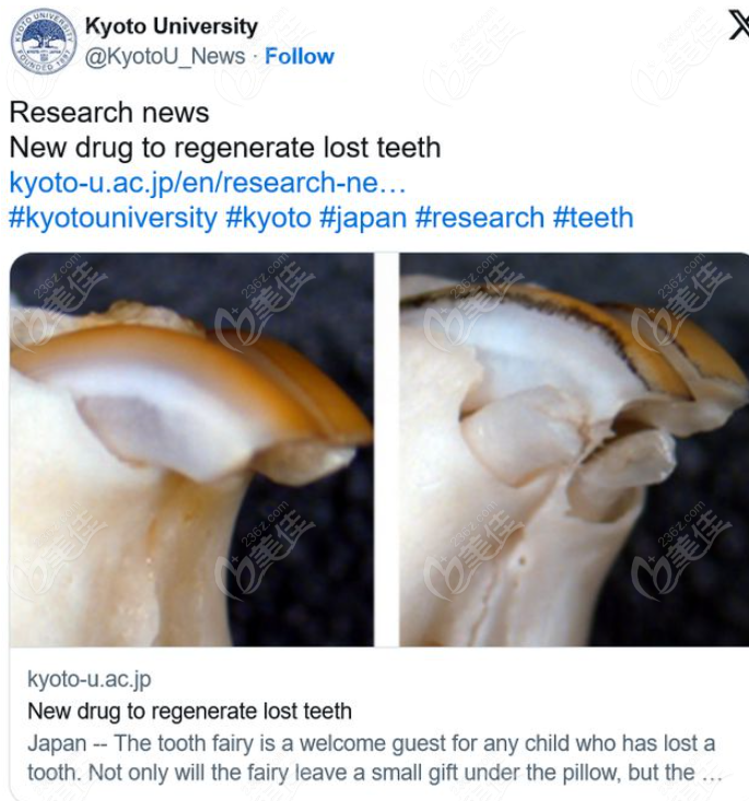 再生牙试验报到