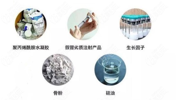 2025国内取注射异物在线询问