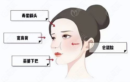 薛志强馒化脸修复价格表一览