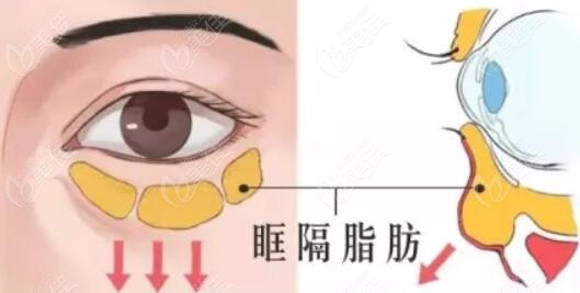 大連不開刀去眼袋哪家好排名：大連愛德麗格等5家優(yōu)質(zhì)無痕去眼袋不開刀醫(yī)院上榜