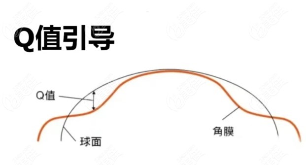 延吉近视眼手术价格
