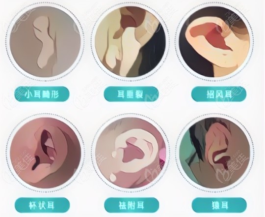 张朝梅医生口碑好
