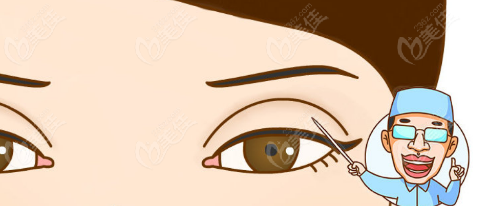 8mm的双眼皮太宽了