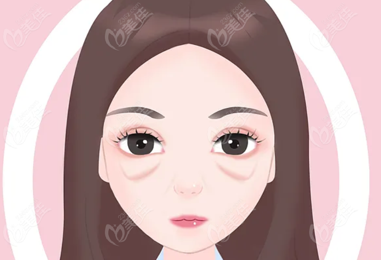 不開刀祛眼袋排名前十醫(yī)院不開刀祛眼袋技術(shù)好 美佳